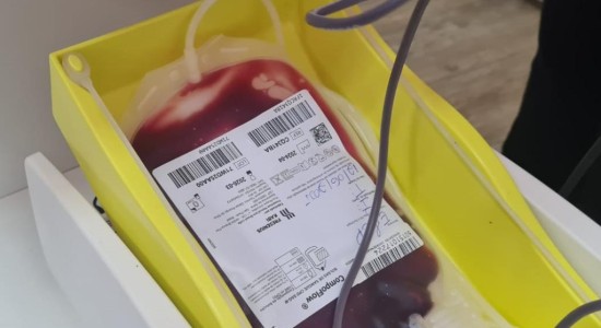MT Hemocentro atende mais de 500 pacientes com a doença falciforme