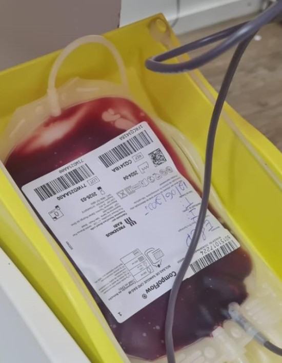 MT Hemocentro atende mais de 500 pacientes com a doença falciforme