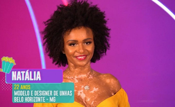 O que é vitiligo? Entenda a doença de Natália Deodato, participante do BBB 22