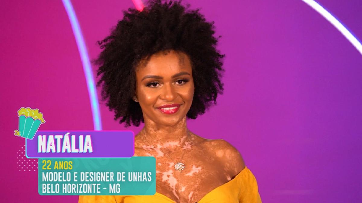 O que é vitiligo? Entenda a doença de Natália Deodato, participante do BBB 22